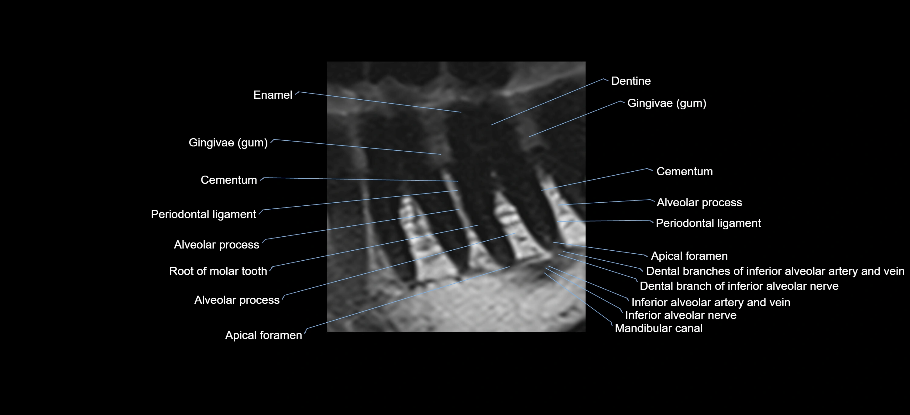 mri tooth sagittal micro cross sectional 3T anatomy -img-00002.webp